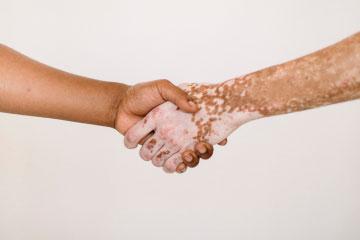 Dos manos estrechándose